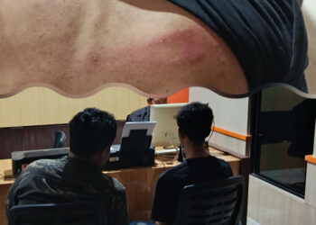 Koordinator BEM Nusantara Dianiaya 4 Orang Tak Dikenal