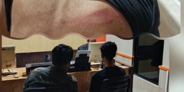 Koordinator BEM Nusantara Dianiaya 4 Orang Tak Dikenal